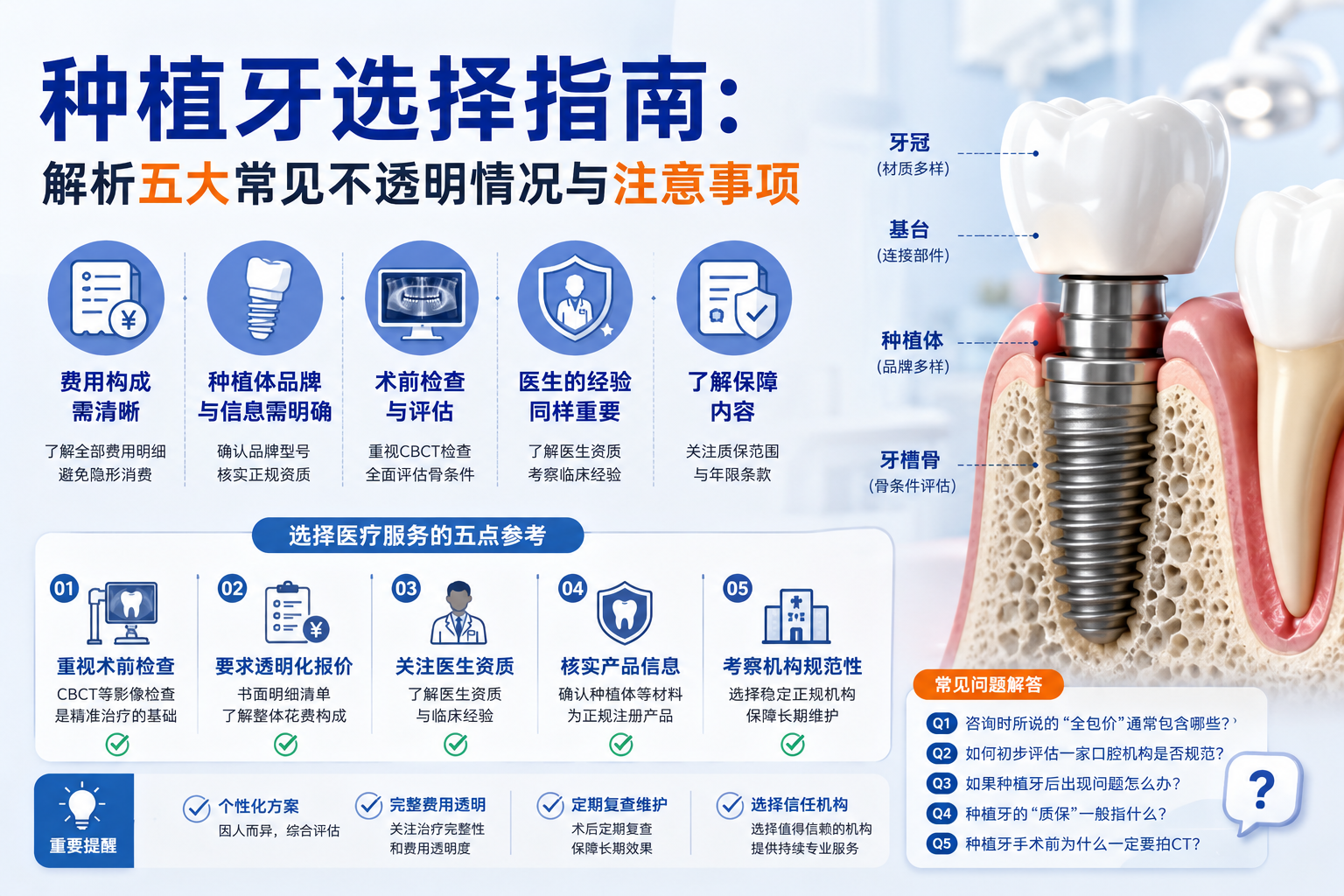 种植牙选择指南：解析五大常见不透明情况与注意事项